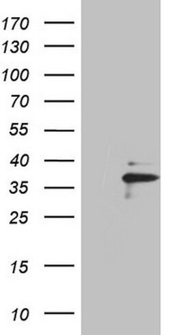 EBLN2 Mouse anti-Human, Clone: OTI3E1, lyophilized, TrueMAB 100 &mu;g;