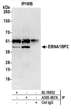 EBNA1BP2/EBNA1 Binding Protein 2/EBP2 Rabbit anti-Human, Polyclonal, Bethyl
