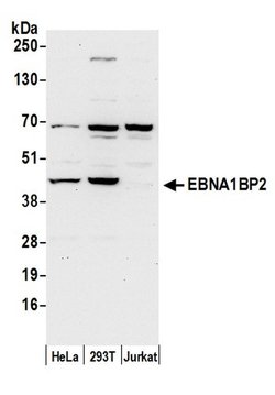 EBNA1BP2/EBNA1 Binding Protein 2/EBP2 Polyclonal Antibody, Bethyl Laboratories:Antibodies:Primary