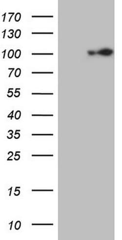 ECT2 Mouse anti-Human, Clone: OTI2D9, liquid, TrueMAB 100 &mu;L; Unconjugated:Antibodies,