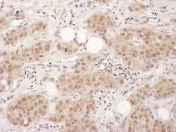 EDF-1 Rabbit anti-Human, Polyclonal, Bethyl Laboratories 100 &mu;L; Unconjugated:Antibodies,