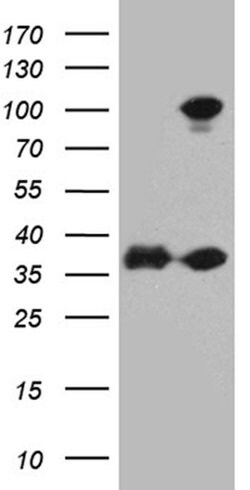 EEF1D Monoclonal Antibody (OTI1B9), TrueMAB , OriGene 100 &mu;L; Unconjugated:Antibodies,