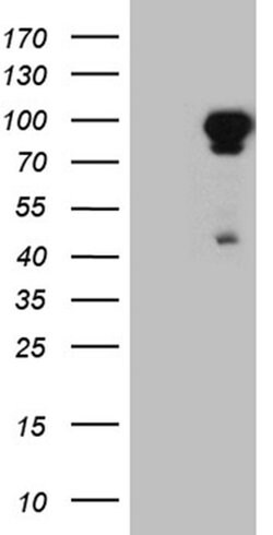 EEF1D Monoclonal Antibody (OTI6E1), TrueMAB , OriGene:Antibodies:Primary