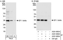 EF-1 delta Rabbit anti-Human, Polyclonal, Bethyl Laboratories 100 &mu;L;
