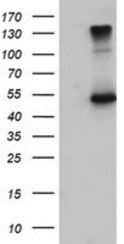 EFEMP1 Mouse anti-Human, Clone: OTI1D9, lyophilized, TrueMAB 100 &mu;g;