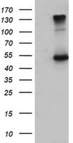 EFEMP1 Mouse anti-Human, Clone: OTI1D9, liquid, TrueMAB 100 &mu;L; Unconjugated:Antibodies,