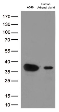 EFHD1 Mouse anti-Human, Clone: OTI1C12, lyophilized, TrueMAB 100 &mu;g;