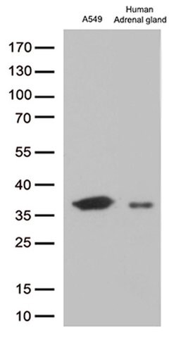 EFHD1 Monoclonal Antibody (OTI2B9), TrueMAB , OriGene 100 &mu;L; Unconjugated:Antibodies,