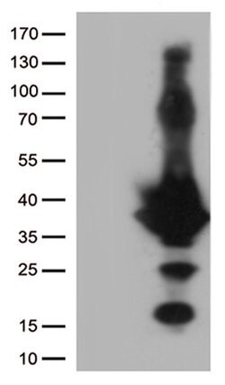 EFHD1 Monoclonal Antibody (OTI8D9), TrueMAB , OriGene:Antibodies:Primary