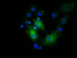 EFNA2 Mouse anti-Human, Clone: OTI3E1, lyophilized, TrueMAB 100 &mu;g;