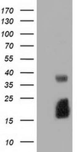 EFNA2 Monoclonal Antibody (OTI2E6), TrueMAB , OriGene 30 &mu;L; Unconjugated:Antibodies,