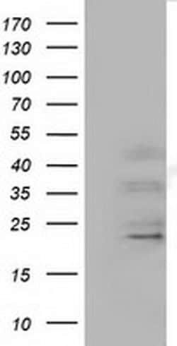 EFNA2 Monoclonal Antibody (OTI2C6), TrueMAB , OriGene:Antibodies:Primary