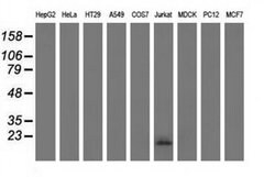 EFNA2 Mouse anti-Human, Clone: OTI2B7, liquid, TrueMAB 100 &mu;L; Unconjugated:Antibodies,