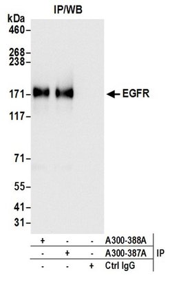 EGFR Rabbit anti-Human, Mouse, Polyclonal, Bethyl Laboratories 100 &mu;L;