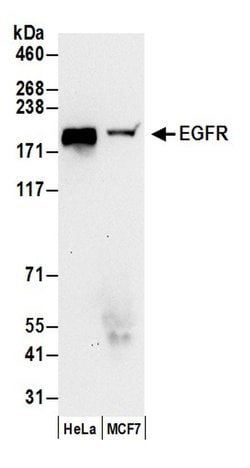 EGFR Polyclonal Antibody, Bethyl Laboratories:Antibodies:Primary Antibodies