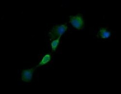 EGFR Monoclonal Antibody (OTI2G8), TrueMAB , OriGene 100 &mu;L; Unconjugated:Antibodies,