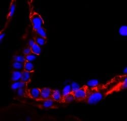 EGFR Polyclonal Antibody, Bethyl Laboratories:Antibodies:Primary Antibodies