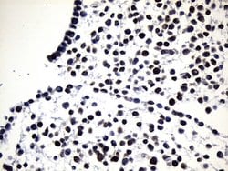 EGFR L858R Mouse anti-Human, Clone: UMAB234, liquid, UltraMAB 100 &mu;L | Buy Online | OriGene | Fisher Scientific