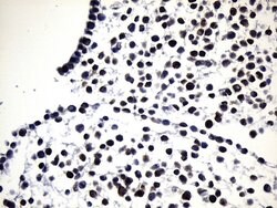 EGFR L858R Mouse anti-Human, Clone: UMAB234, lyophilized, UltraMAB 100