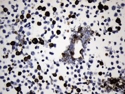 EGFR L858R Mouse anti-Human, Clone: UMAB234, liquid, UltraMAB 100 &mu;L | Buy Online | OriGene | Fisher Scientific