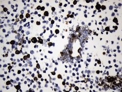 EGFR L858R Mouse anti-Human, Clone: UMAB234, lyophilized, UltraMAB 100