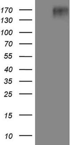 EGFR L858R Mouse anti-Human, Clone: OTI2F5, lyophilized, TrueMAB 100 &mu;g;