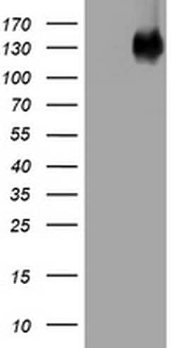 EGFR Monoclonal Antibody (OTI1E5), TrueMAB , OriGene:Antibodies:Primary