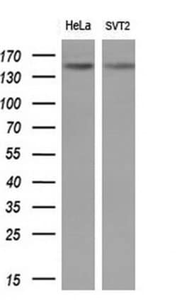 EGFR Monoclonal Antibody (OTI1E5), TrueMAB , OriGene:Antibodies:Primary