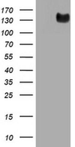 EGFR Monoclonal Antibody (OTI3F2), TrueMAB , OriGene:Antibodies:Primary