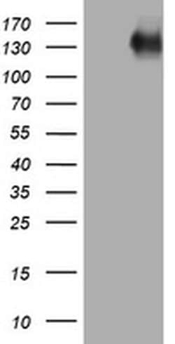 EGFR Monoclonal Antibody (OTI6F5), TrueMAB , OriGene 100 &mu;L; Unconjugated:Antibodies,