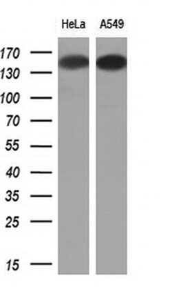 EGFR Monoclonal Antibody (OTI6F5), TrueMAB , OriGene 100 &mu;L; Unconjugated:Antibodies,