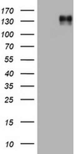 EGFR Monoclonal Antibody (OTI1B6), TrueMAB , OriGene 30 &mu;L | Buy Online | Origene Technologies | Fisher Scientific