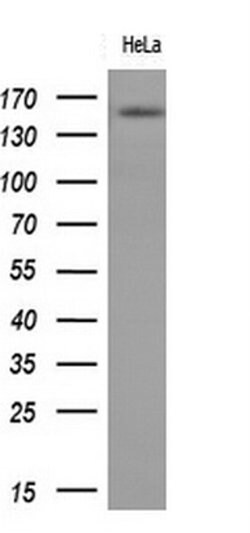 EGFR Monoclonal Antibody (OTI1B6), TrueMAB , OriGene 30 &mu;L | Buy Online | Origene Technologies | Fisher Scientific