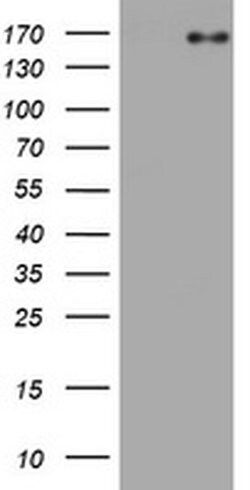 EGFR Monoclonal Antibody (OTI3D7), TrueMAB , OriGene 30 &mu;L; Unconjugated:Antibodies,