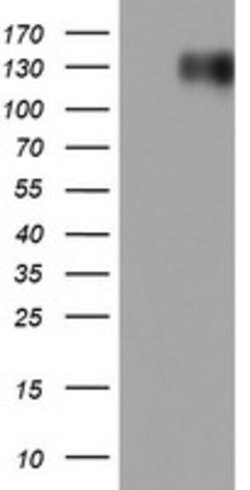 EGFR Mouse anti-Human, Clone: OTI9G6, lyophilized, TrueMAB 100 &mu;g; Unconjugated:Antibodies,