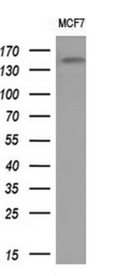 EGFR Mouse anti-Human, Clone: OTI9G6, lyophilized, TrueMAB 100 &mu;g; Unconjugated:Antibodies,