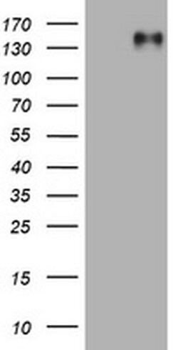 EGFR Monoclonal Antibody (OTI8E6), TrueMAB , OriGene 100 &mu;L; Unconjugated:Antibodies,