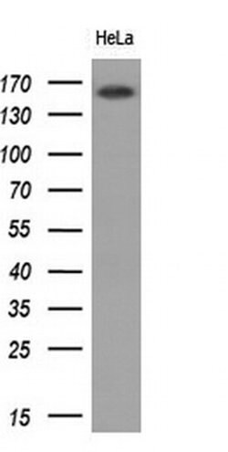EGFR Monoclonal Antibody (OTI8E6), TrueMAB , OriGene 100 &mu;L; Unconjugated:Antibodies,