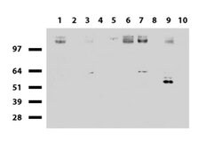 EGFR Mouse anti-Canine, Human, Clone: UMAB95, liquid, UltraMAB 100 &mu;L;
