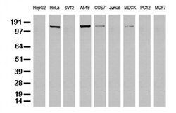 EGFR Mouse anti-Canine, Human, Clone: UMAB95, liquid, UltraMAB 100 &mu;L;