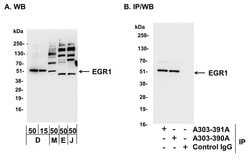 EGR1 Rabbit anti-Human, Mouse, Polyclonal, Bethyl Laboratories 100 &mu;L;