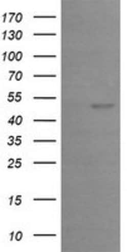 EGR2 Mouse anti-Human, Clone: OTI1F10, lyophilized, TrueMAB 100 &mu;g;