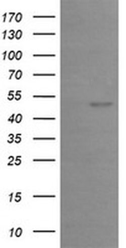 EGR2 Monoclonal Antibody (OTI1F10), TrueMAB , OriGene 100 &mu;L; Unconjugated:Antibodies,