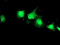 EIF2B3 Monoclonal Antibody (OTI1H3), TrueMAB , OriGene 100 &mu;L; Unconjugated:Antibodies,