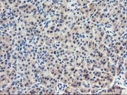EIF2B3 Monoclonal Antibody (OTI1H3), TrueMAB , OriGene 100 &mu;L; Unconjugated:Antibodies,