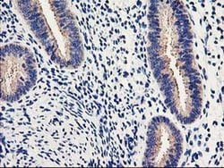 EIF2B3 Monoclonal Antibody (OTI1H3), TrueMAB , OriGene 100 &mu;L; Unconjugated:Antibodies,