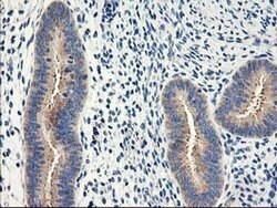 EIF2B3 Monoclonal Antibody (OTI1D6), TrueMAB , OriGene 30 &mu;L; Unconjugated:Antibodies,