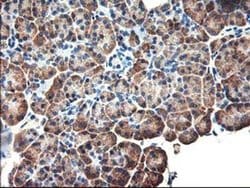 EIF2B3 Monoclonal Antibody (OTI3H3), TrueMAB , OriGene:Antibodies:Primary
