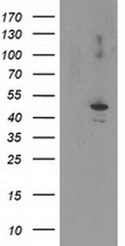 EIF2B3 Monoclonal Antibody (OTI1H3), TrueMAB , OriGene 100 &mu;L; Unconjugated:Antibodies,