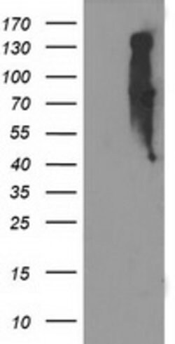 EIF2B3 Mouse anti-Human, Clone: OTI2D2, lyophilized, TrueMAB 100 &mu;g;